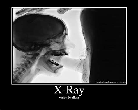 porn x ray|'x ray' Search .